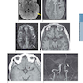 HARRISONS PRINCIPLES OF INTERNAL MEDICINE Part Neurologic Disorders