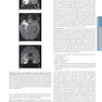 HARRISONS PRINCIPLES OF INTERNAL MEDICINE Part Neurologic Disorders