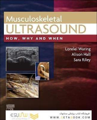 Musculoskeletal Ultrasound: How, Why and When 1st Edición