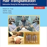 Practical Guide to Hair Transplantation