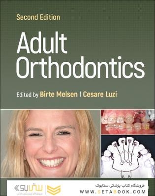 Adult Orthodontics 2nd Edicion
