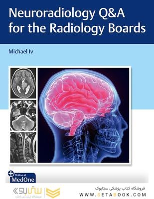 Neuroradiology Q-A for the Radiology Boards