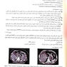سوالات بورد جراحی عمومی 1399 همراه با پاسخ تشریحی