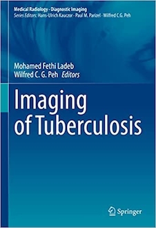 عکس Imaging of Tuberculosis