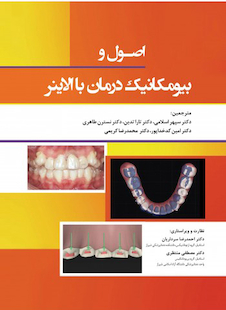 عکس اصول و بیومکانیک درمان با الاینر 2022