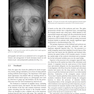 Master Techniques in Blepharoplasty and Periorbital Rejuvenation