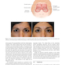 Master Techniques in Blepharoplasty and Periorbital Rejuvenation