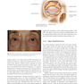 Master Techniques in Blepharoplasty and Periorbital Rejuvenation