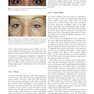 Master Techniques in Blepharoplasty and Periorbital Rejuvenation