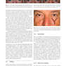 Master Techniques in Blepharoplasty and Periorbital Rejuvenation