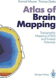 عکس Atlas of Brain Mapping : Topographic Mapping of Electroencephalography and Evoked Potentials