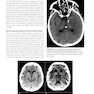 Clinical Neurology and Neuroanatomy: A Localization-Based Approach, Second Edition 2nd Edition