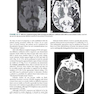 Clinical Neurology and Neuroanatomy: A Localization-Based Approach, Second Edition 2nd Edition