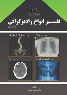 عکس آموزش پایه تا پیشرفته تفسیر انواع رادیوگرافی در اورژانس