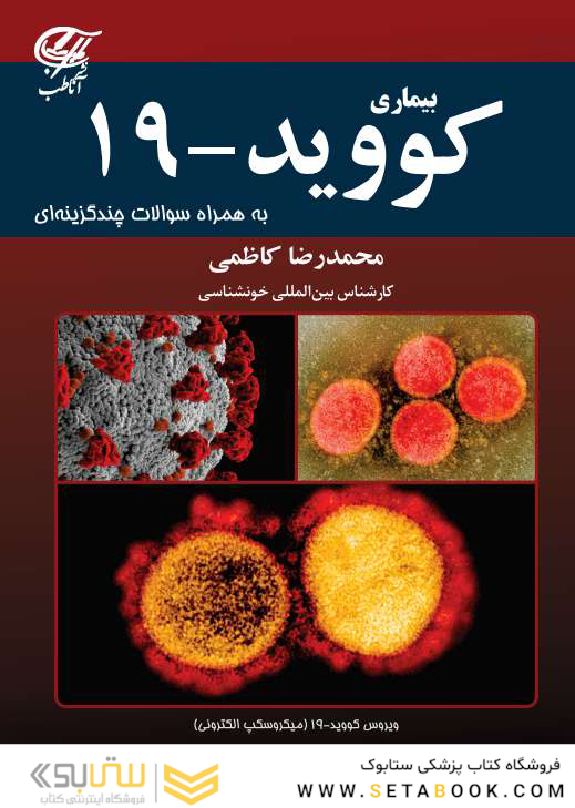 بیماری کووید-19 به همراه سوالات چندگزینه ای