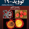 بیماری کووید-19 به همراه سوالات چندگزینه ای