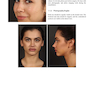 Aesthetic Septorhinoplasty 2021