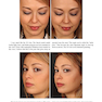 Aesthetic Septorhinoplasty 2021