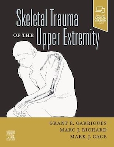 عکس Skeletal Trauma of the Upper Extremity