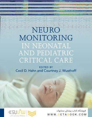 Neuromonitoring in Neonatal and Pediatric Critical Care