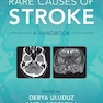 Rare Causes of Stroke: A Handbook