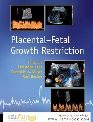 Placental-Fetal Growth Restriction