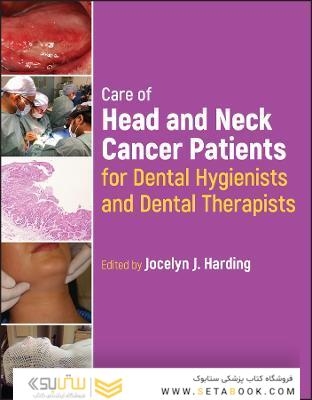 Care of Head and Neck Cancer Patients for Dental Hygienists and Dental Therapists