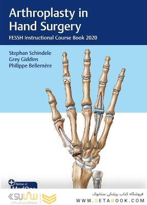 Arthroplasty in Hand Surgery: FESSH Instructional Course Book