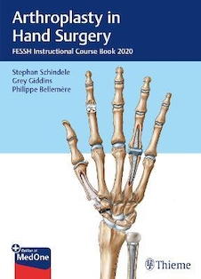 عکس Arthroplasty in Hand Surgery: FESSH Instructional Course Book