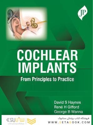 Cochlear Implants: From Principles to Practice