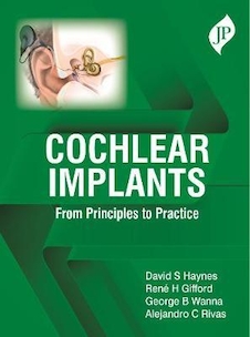 عکس Cochlear Implants: From Principles to Practice