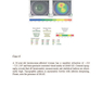 Diagnostics in Ocular Imaging: Cornea, Retina, Glaucoma and Orbit