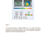 Diagnostics in Ocular Imaging: Cornea, Retina, Glaucoma and Orbit