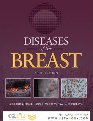 Diseases of the Breast