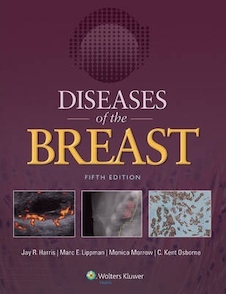 عکس Diseases of the Breast
