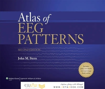 Atlas of EEG Patterns