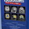 اطلس ساختمان ها ی طبیعی مغز در MRI و PET scan