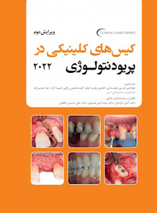عکس کیس های کلینیکی در پریودنتولوژی 2022