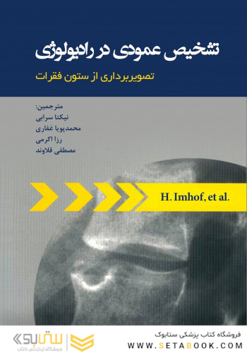 تشخیص عمودی در رادیولوژی با تصویربرداری از ستون فقرات