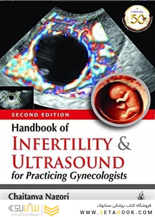 Handbook of Infertility and Ultrasound for Practicing Gynecologists 2Edition