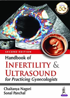 عکس Handbook of Infertility and Ultrasound for Practicing Gynecologists 2Edition