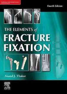 عکس The elements of fracture fixation, 4e Kindle Edition