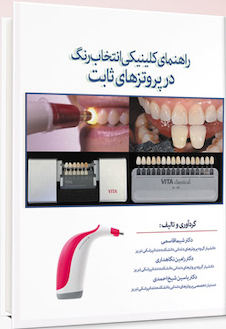 عکس راهنمای کلینیکی انتخاب رنگ در پروتزهای ثابت
