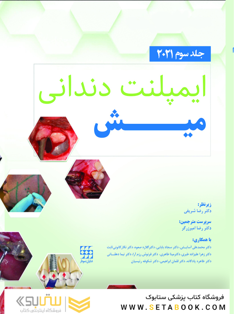 ایمپلنت دندانی میش 2021 جلد سوم