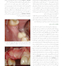 ایمپلنت دندانی میش 2021 جلد سوم