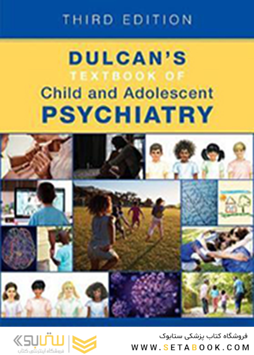 Dulcan
