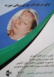 عکس اولین مرجع طب سوزنی زیبایی صورت 2022