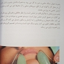 اولین مرجع طب سوزنی زیبایی صورت 2022