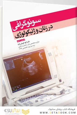 سونوگرافی در زنان و ژنیکولوژی