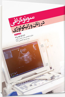 عکس سونوگرافی در زنان و ژنیکولوژی